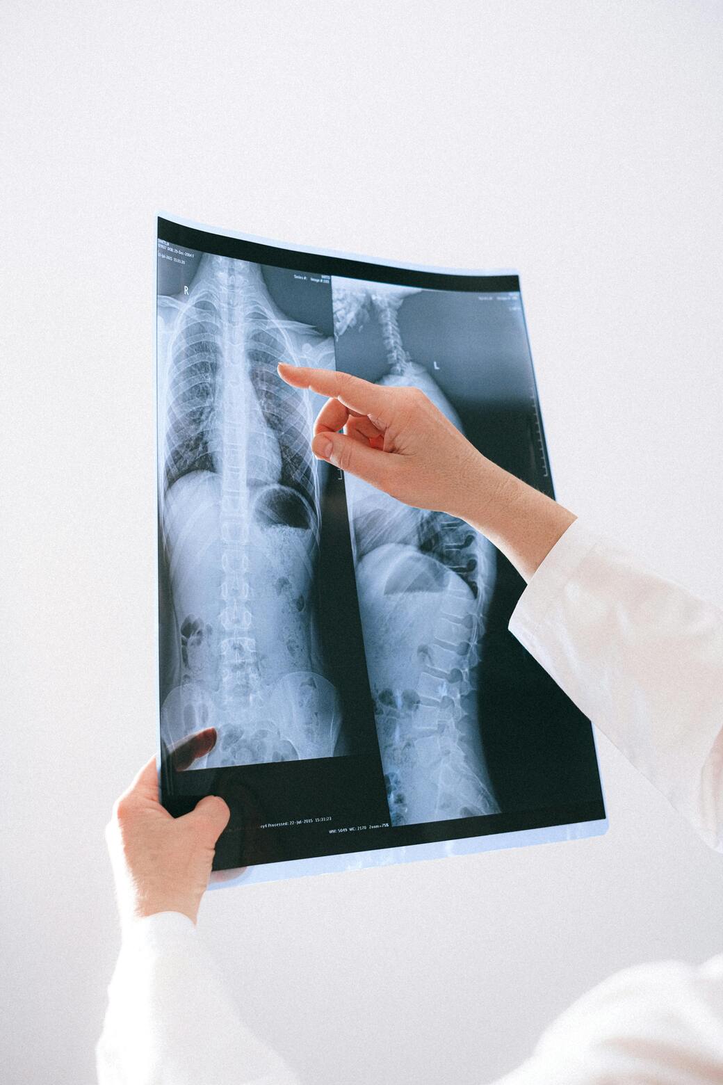 Dr Predrag Ćirković: Radiologija ima ključnu ulogu u ranom otkrivanju malignih bolesti
